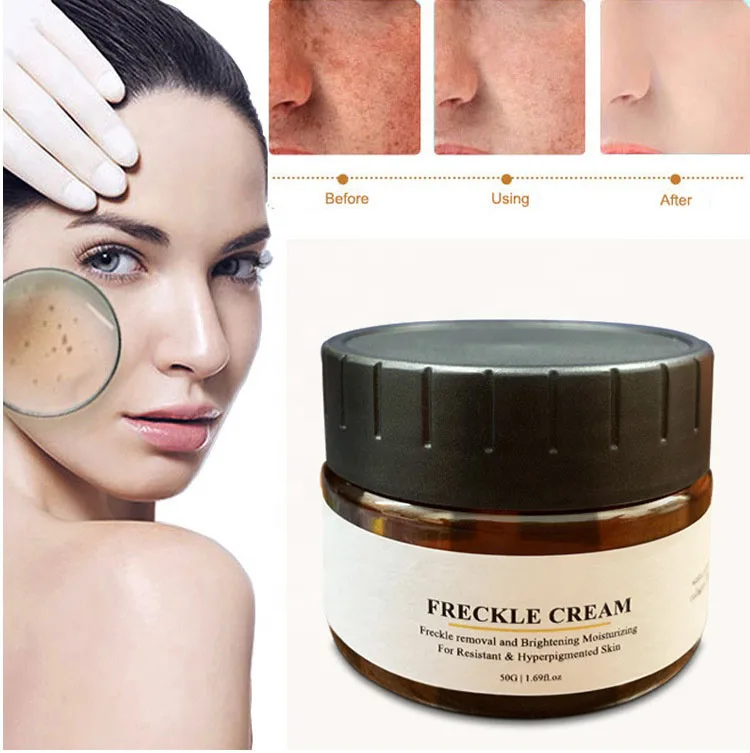 Natural Pearl Skin Glycolic Acid And Lactic Acid Lightening Bleaching