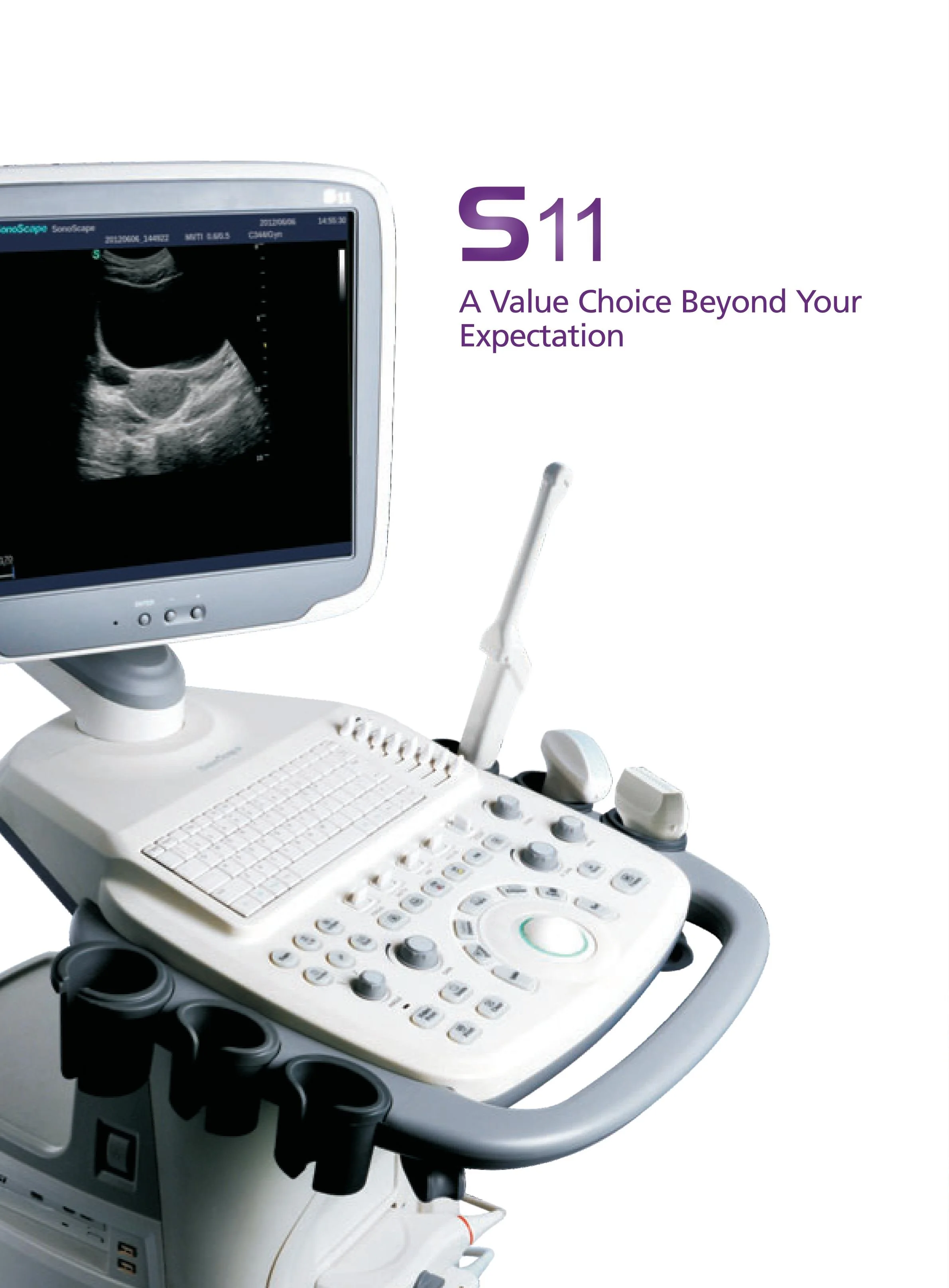 Sonoscape S11 Trolley Color Doppler Ultrasound system USG 15-inch High-Resolution Color LCD