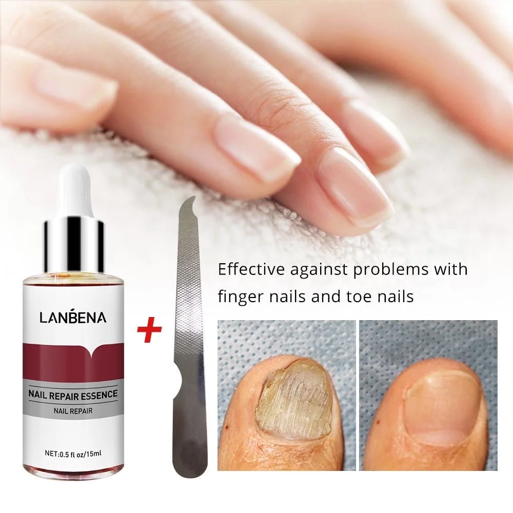 Wholesale Auquest Brand Natural Organic Nail Care Paronychia Fungal Nail  Treatment Nourishing Repair Nail Serum Buy Nail Serum,Nail Repair,Fungus Nail  Treatment Product On | 1pc Nails Repairing Serum Nourishing Nails Essence  Nail