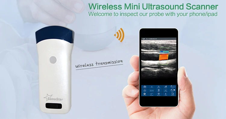 wireless ultrasound scanner machine.jpg