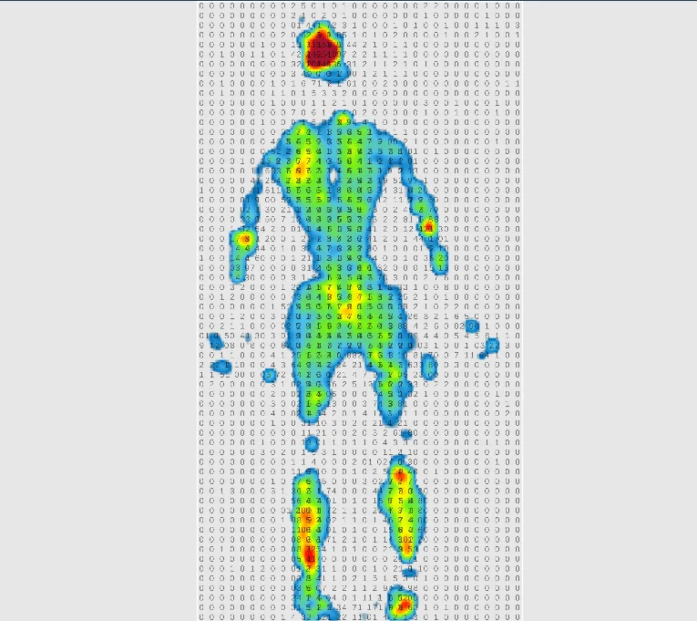 32x32 FSR Matrix Mattress | Pressure Mapping System for Bedsores ...