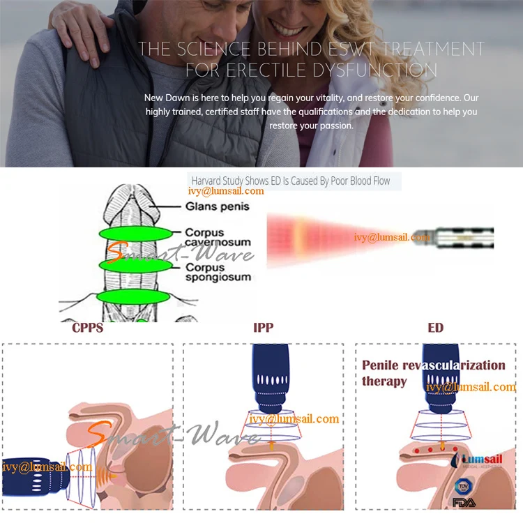 体外冲击波治疗难治性慢性非小细胞前列腺炎的远期疗效观察
