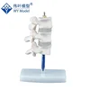 Osteoporosis Models,Cut Lumbar Vertebrae Spinal Column Joint Model
