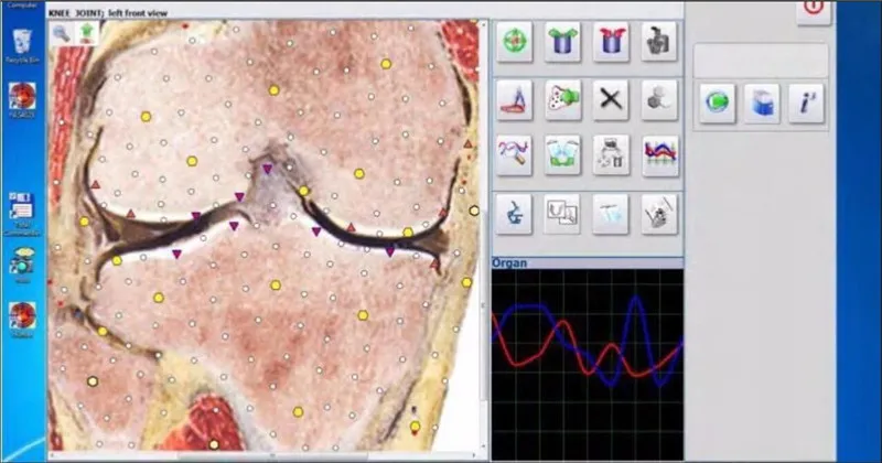 JYTOP Bioresonance Health Scan and Therapy Hunter 4025 NLS