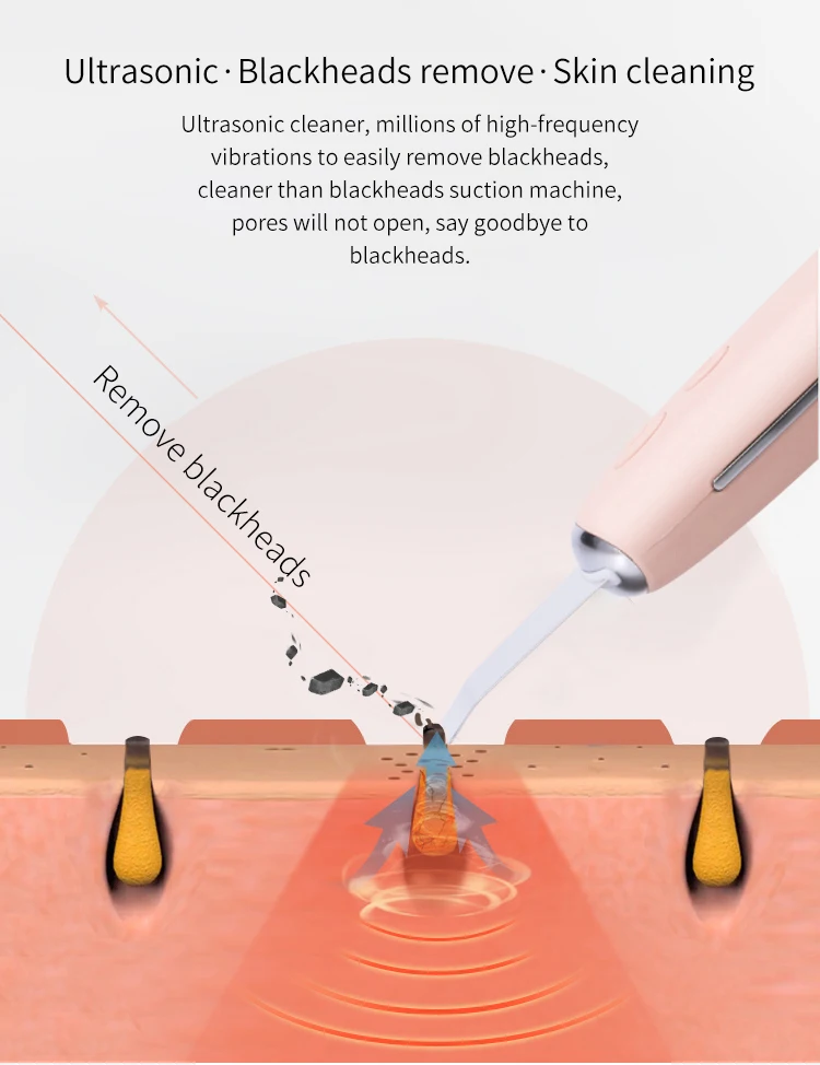 Innovative Ultrasonic Skin Scrubber Multifunction Dead Skin Remover Tool For Face Cleaning Buy