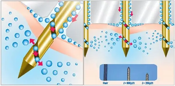 Micro needle-16.jpg