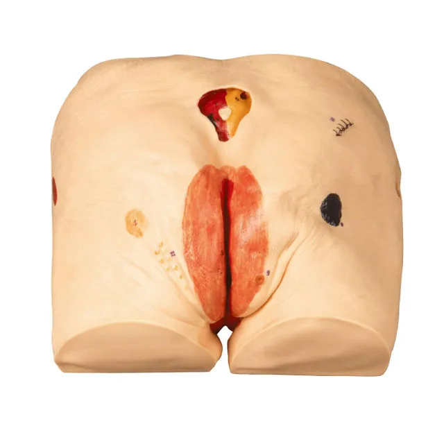 gd/h90e general doctor decubitus ulcer care model(medical model)