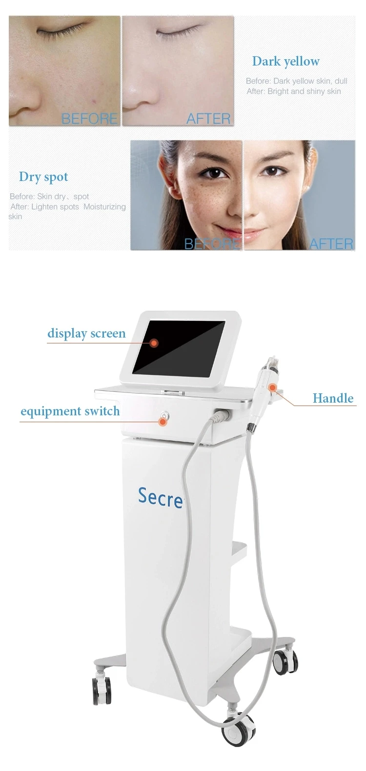 Fractional Microneedle RF Machine for Acne Scar Stretch Marks Removal rf microneedling machine fractional