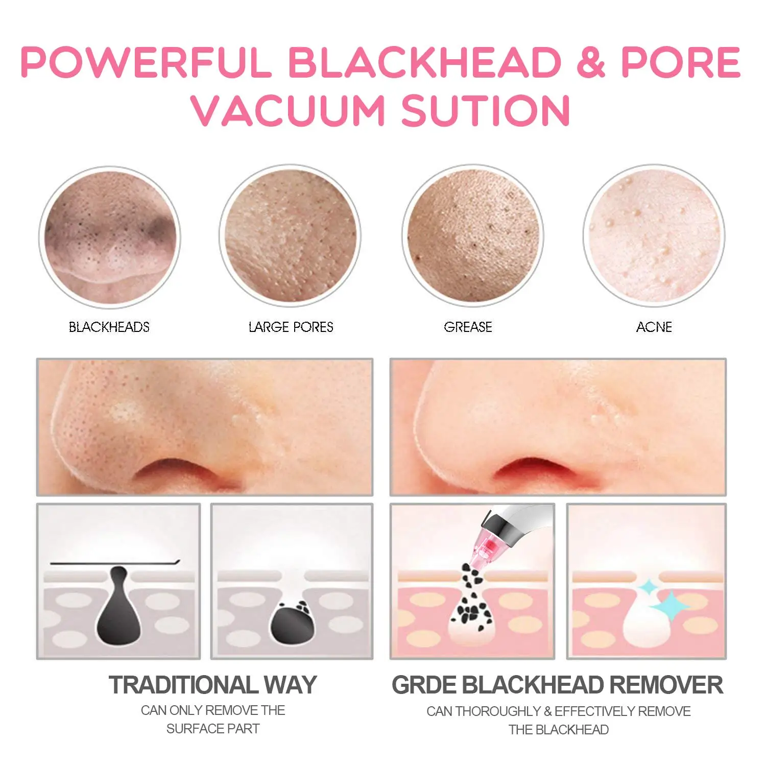 pore cleaner0073.jpg