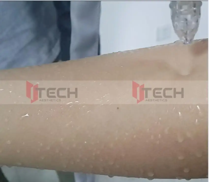 wholesale triple nozzles oxygen jet peel handpiece/oxygen jet clear handpiece