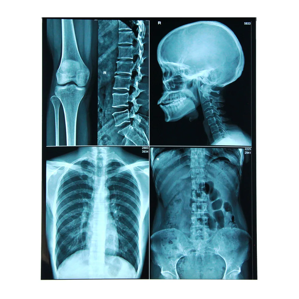 wholesale price fiji digital x ray film carestream film radiolog