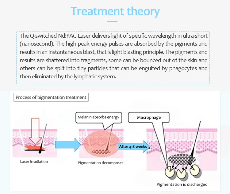 tattoo removal 2.jpg