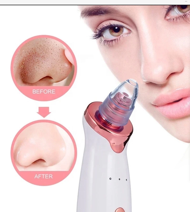 Tool Kit Suction Device Pore Remove Nose Cleanser Set Machine Facial