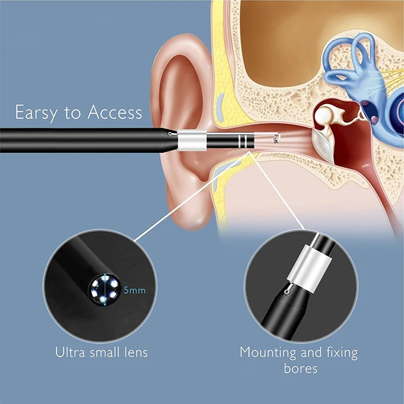 ear wax removal (3).jpg