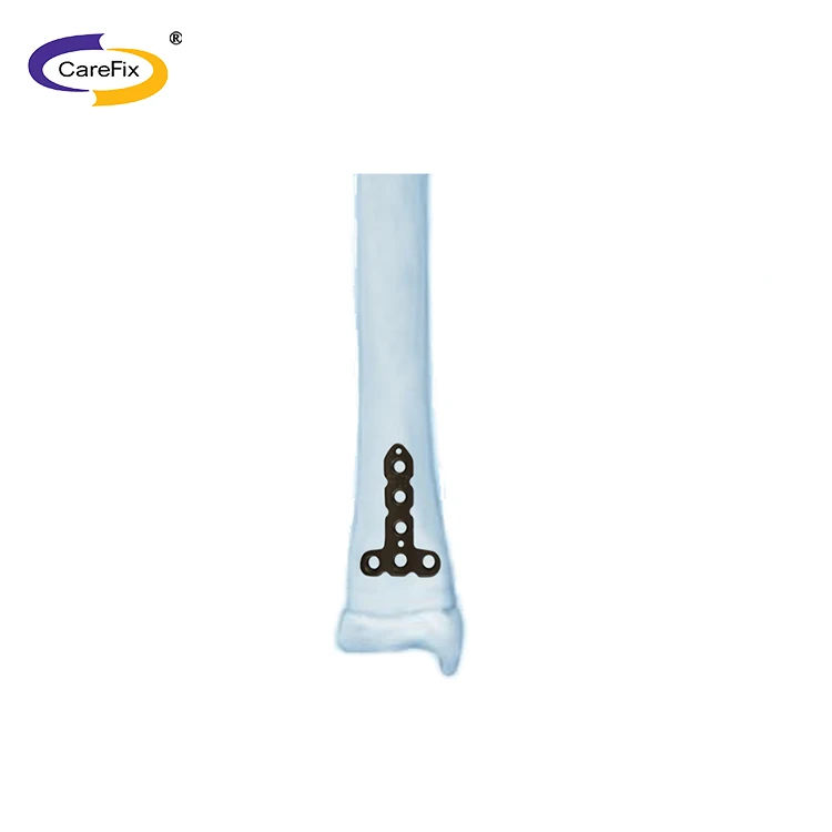 pediatric plate2.jpg