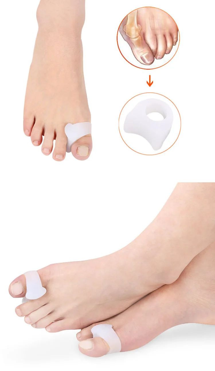 toe correctors.jpg