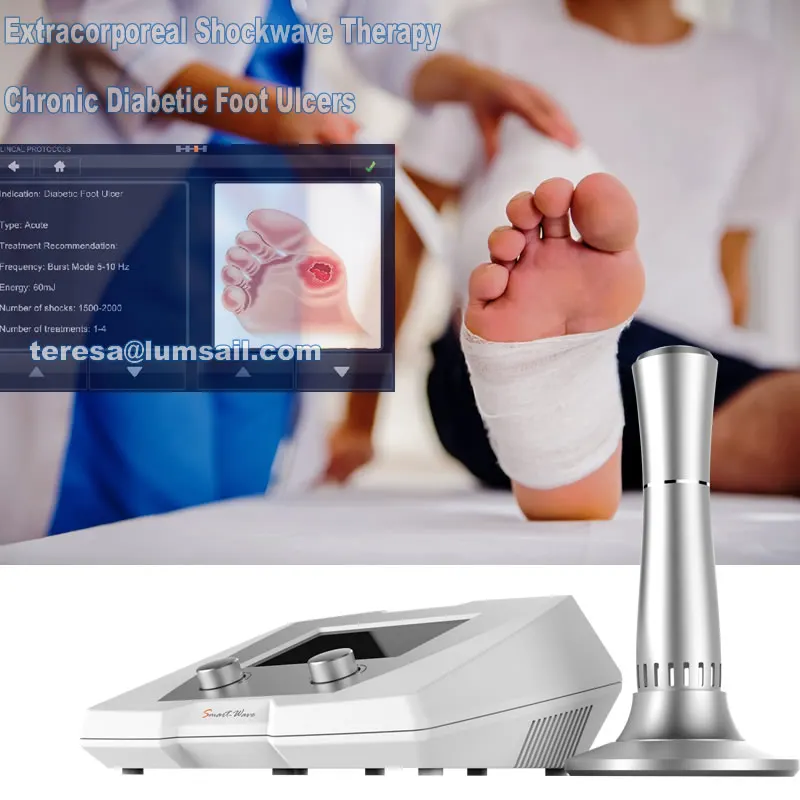 Terapia De Ondas De Choque Extracorporeas Extendida Para Ulceras De Pies Diabeticos Cronicas Buy Chronic Diabetic Foot Ulcers Extracorporeal Shockwave Therapy Extracorporeal Shockwave Therapy For Chronic Diabetic Foot Ulcers Product On Alibaba Com