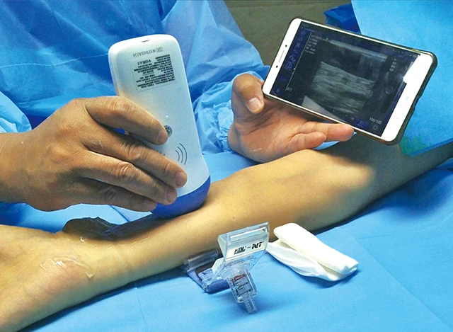 wireless ultrasound scanner machine.jpg