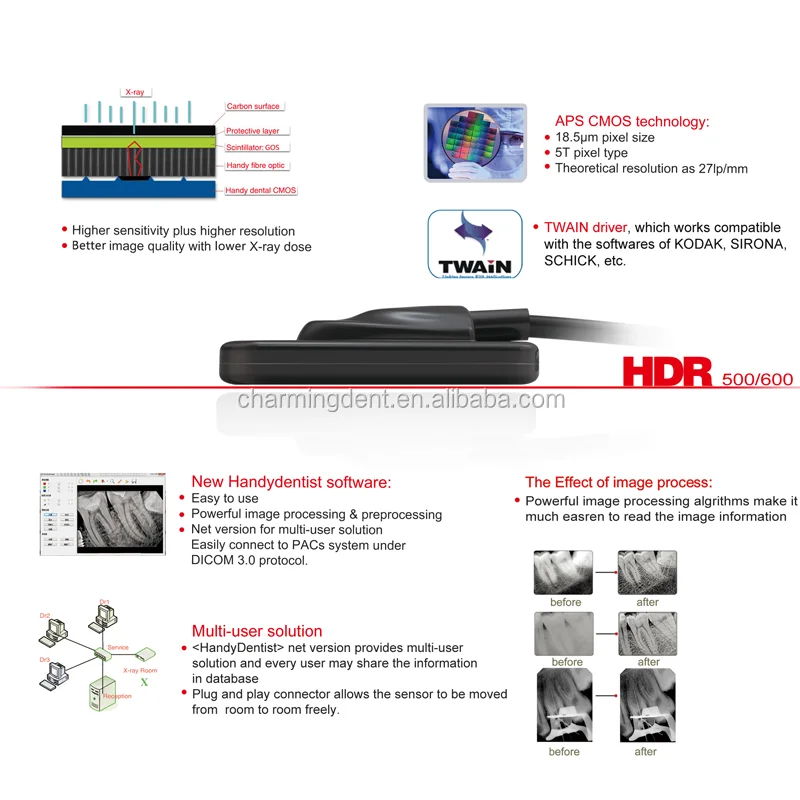 Handy Dental Xray Sensor Dental Rvg / Hdr System Digital Intraoral