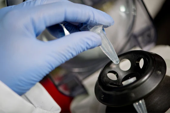 Nucliec Acid Extraction.jpg