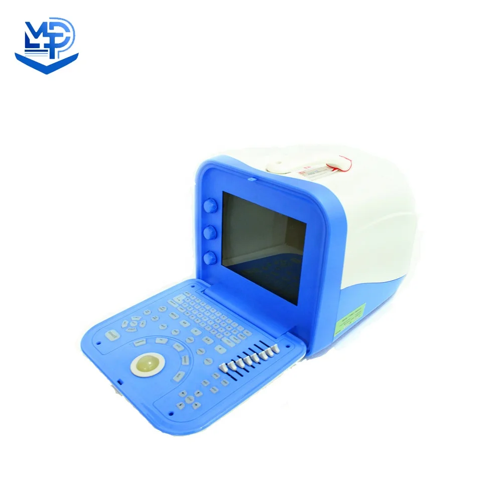 Full Digital Portable Ultrasound Scanner Medical Ultrasound Instruments  machine uptodate medical details