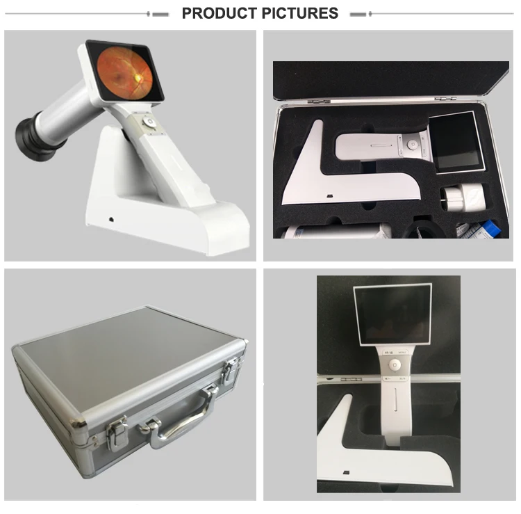 China best quality hand-held digital fundus camera