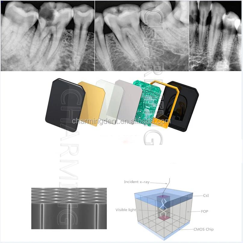 Promotion Price Dental Xray Sensor Rvg Handy Hdr 500 / Wireless Dental Digital Sensors