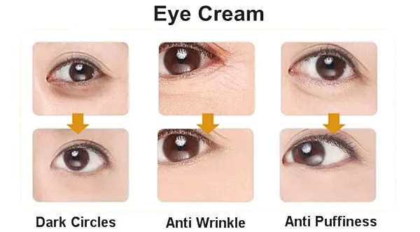 eye cream for puffy eyes