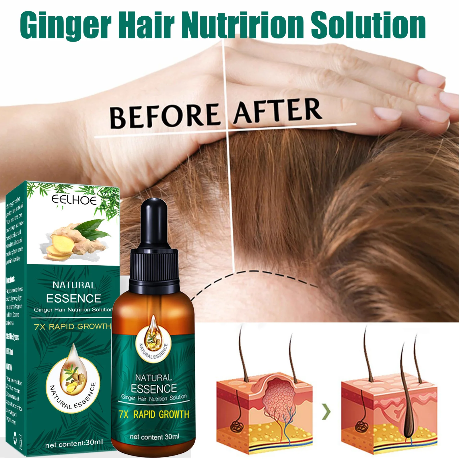 Ginger Hair Growth Essential Oil Serum For Hair Treatment For Women SWEET T  52 | Hair Growth Products Ginger Fast Repair Hair Essential Oil Hair Care  Prevent Hair Loss Oil Scalp Treatment