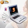 hospitals and clinic micro computer technology Sun-800D ultrasound scanner