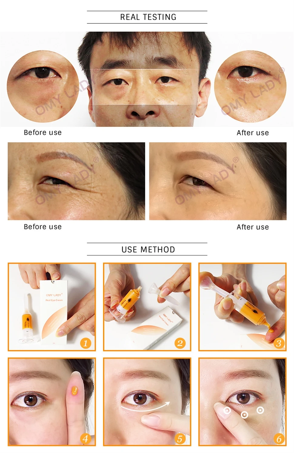 Omy Lady Instant Remove Eyebags Serum Firming Eye Anti Puffiness Dark Circles Under Eye Anti