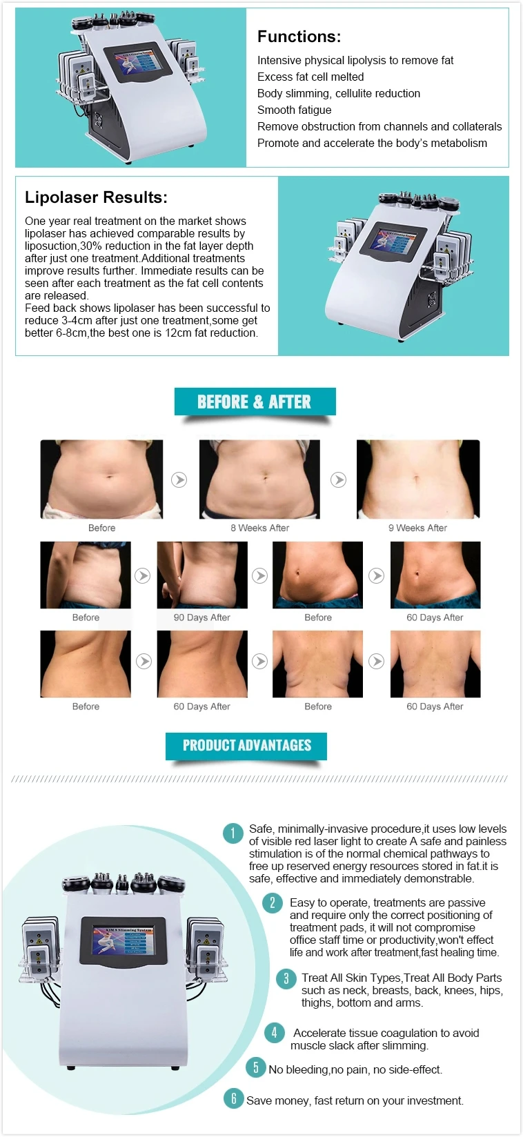 Multifunctional anti cellulite body with great price 80k cavitation machine Plastic home use liposonix
