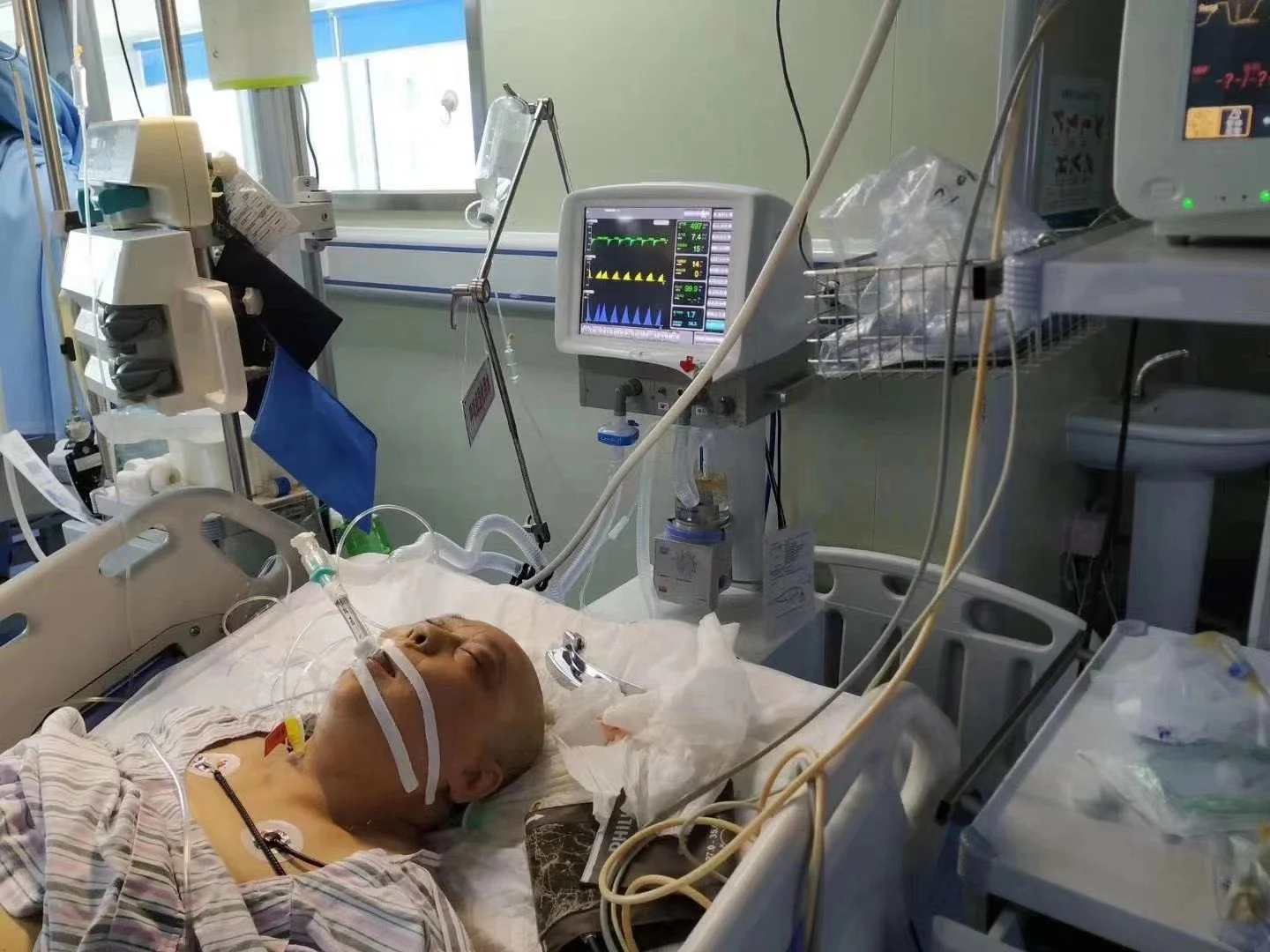 Ventilator Of Icu & Emergency Superstar S1100 Factory Supply Respirator