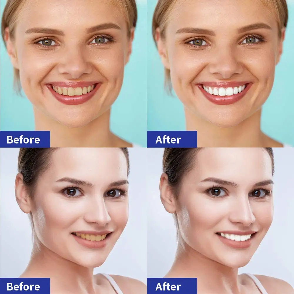 teeth whitening strips (5).jpg