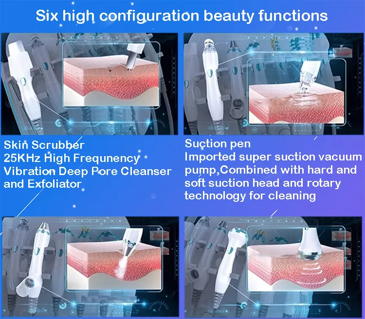 SW-584B_ENP1_Detail(3)
