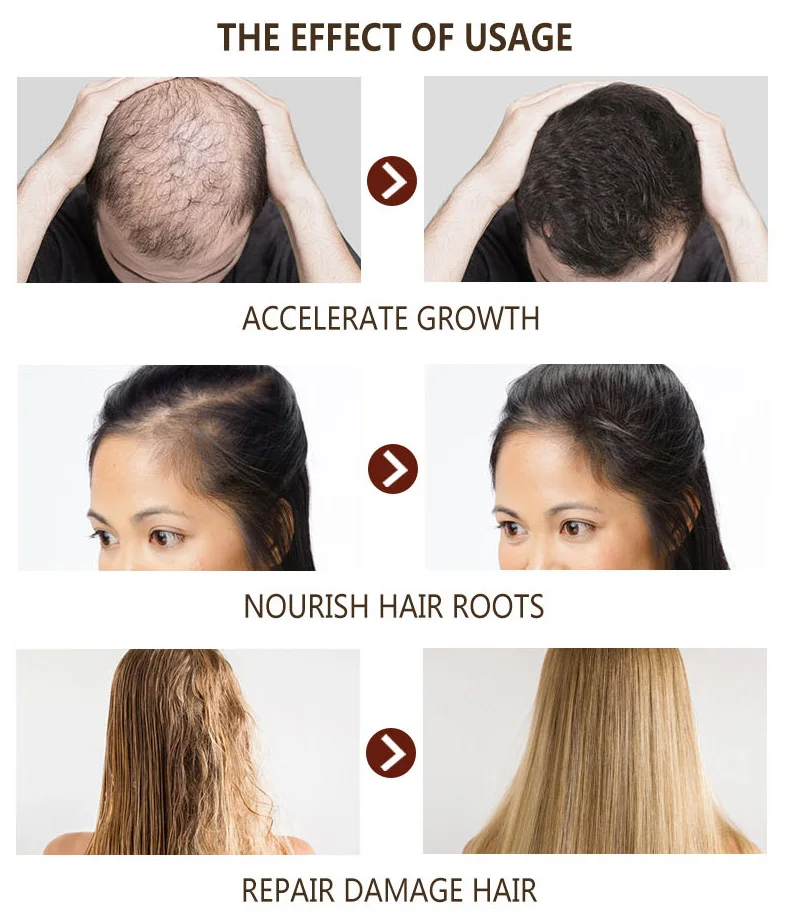 Disaar 30ML Natural Hair Loss Treatment Hair Growth Essential Oil for Men and Women Private Label