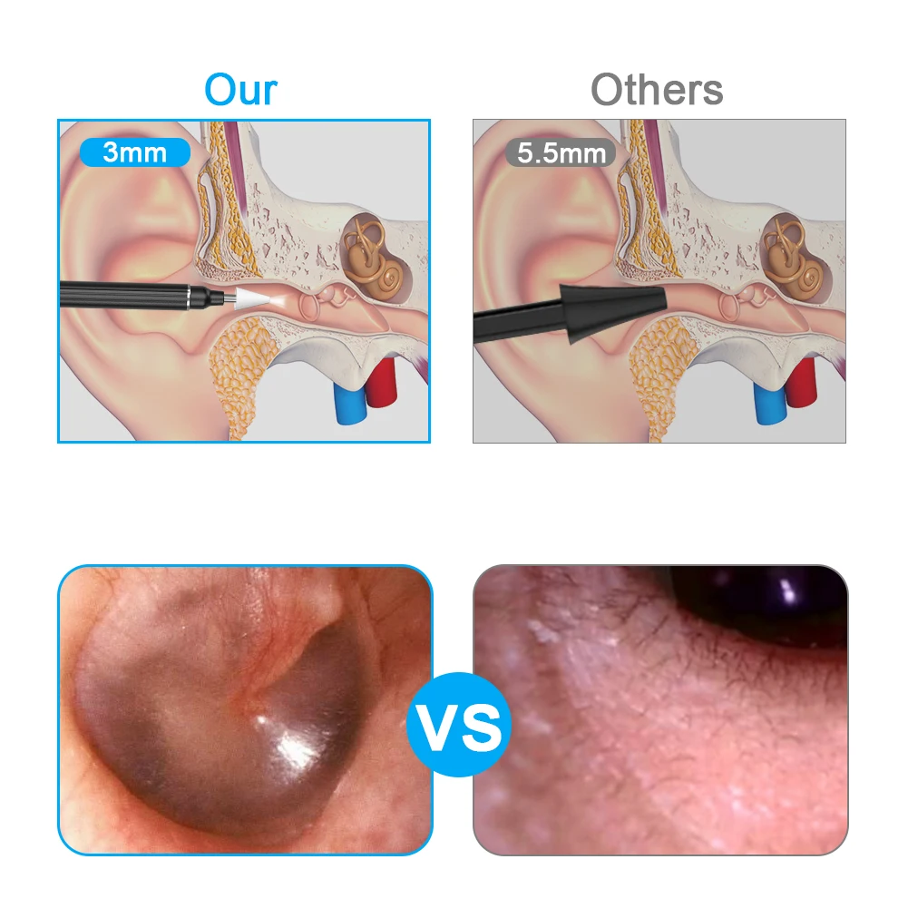 electric ear cleaning