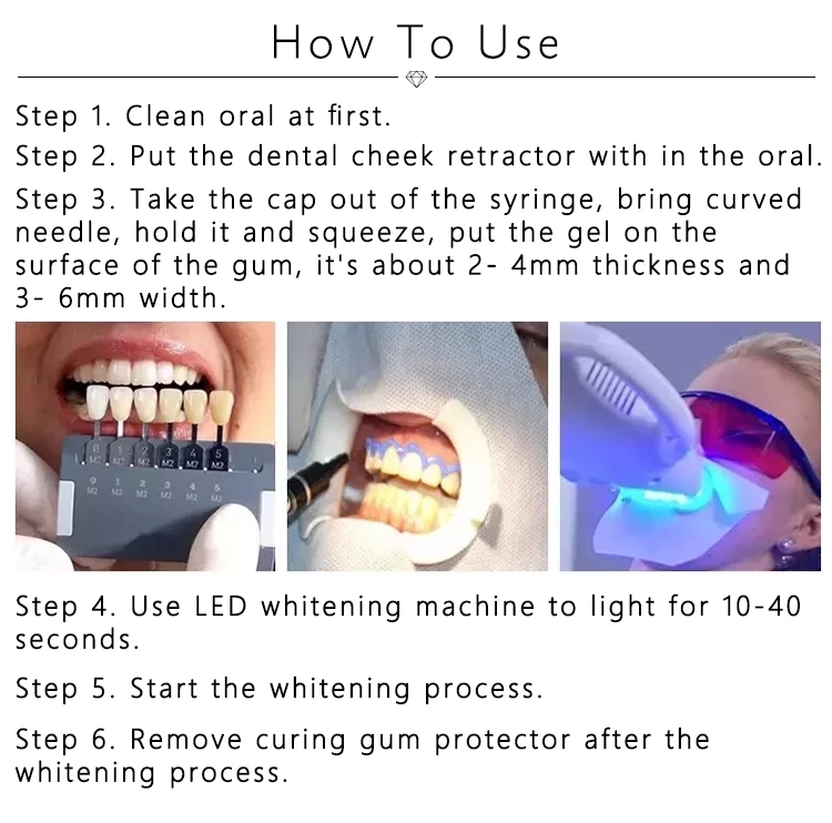 Professional Barriere Gingivale,Blue Gel Teeth Whitening Gum Protector