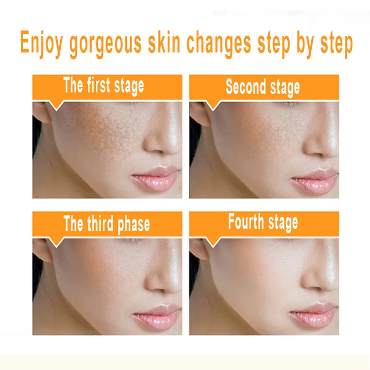 Private Label Wholesale Facial Skin Care Beauty Whitening Anti Best Freckle Removing Cream