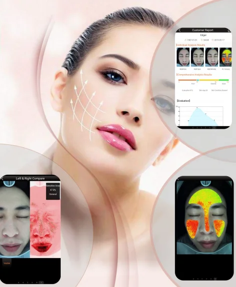 Newest 3d Face Skin Scanner Analyzer Skin Analysis Facial Beauty Buy 3d Skin Analyzer Skin Scanner Analyzer Skin Analysis Facial Beauty Product On Alibaba Com