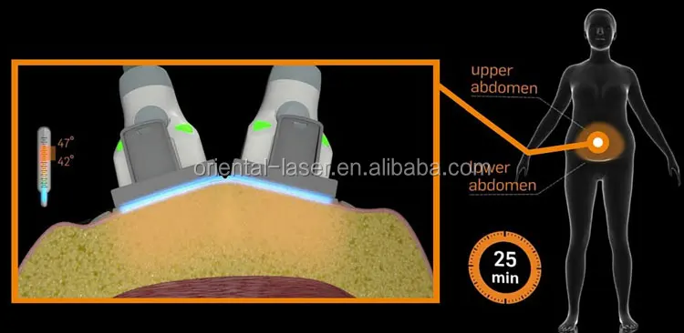  Oriental 2018 Hot sale Ultrasonic Cavitation Vacuum Rf Slimming Machine mychway lipo laser slimming machine .jpg