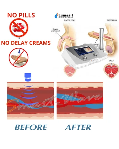 Penile rehabilitation shockwave device BS-SWT2X portable radial ed shock wave therapy
