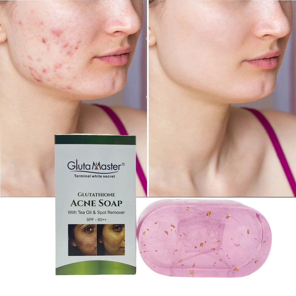 glutathione pimples Gluta Master Glutathione Acne Pimples Soap