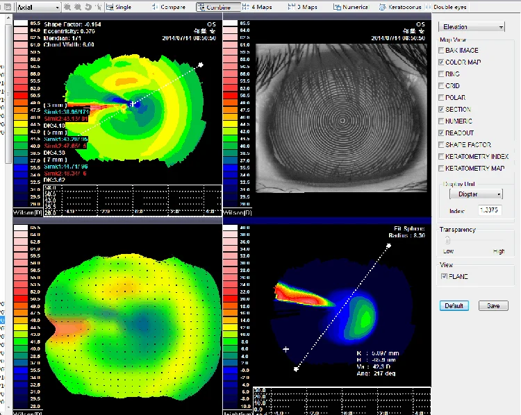 SW-6000 Cheap Price Ophthalmic Topographer Equipment China Corneal Topography