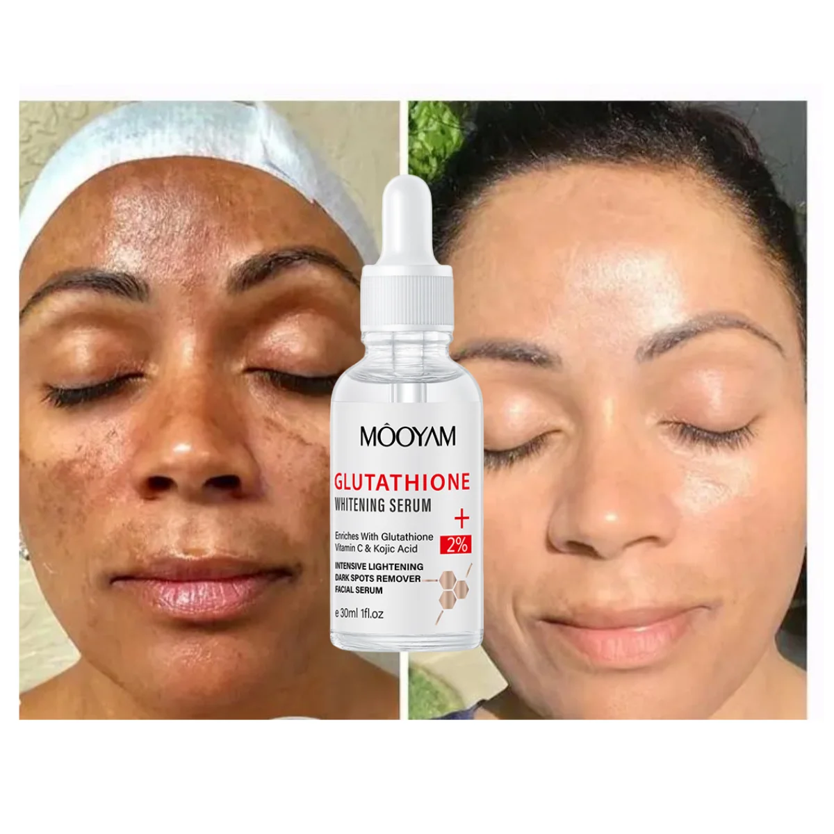 glutathione serum for skin whitening Glutathione Serum Skin Whitening Freckle Serum Korean Skin Care Remove  Melasma Dark Spots Serum With Kojic Acid Vitamin C