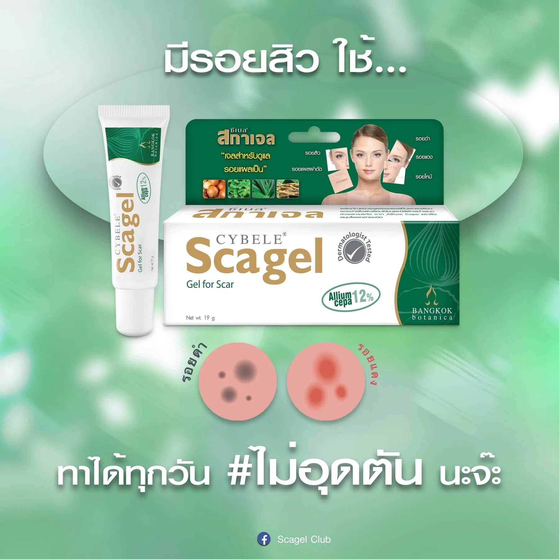 Cybele Scagel Reduces Scars Natural Ingredients Solve All Scar Problems