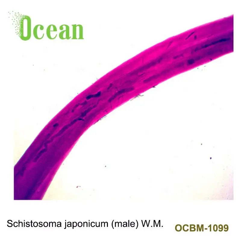 Schistosoma japonicum