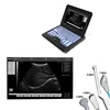 /product-detail/contec-cms600p2-portable-laptop-ultrasound-laptop-ultrasound-scanner-machine-laptop-diagnostic-machine-60701666290.html