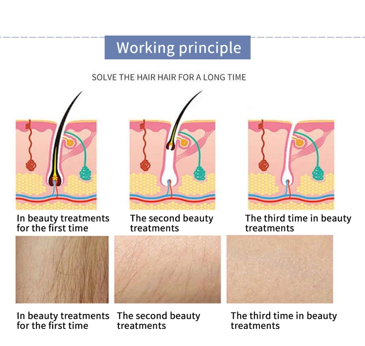 Portable IPL machine opt skin rejuvenation shr hair removal machine