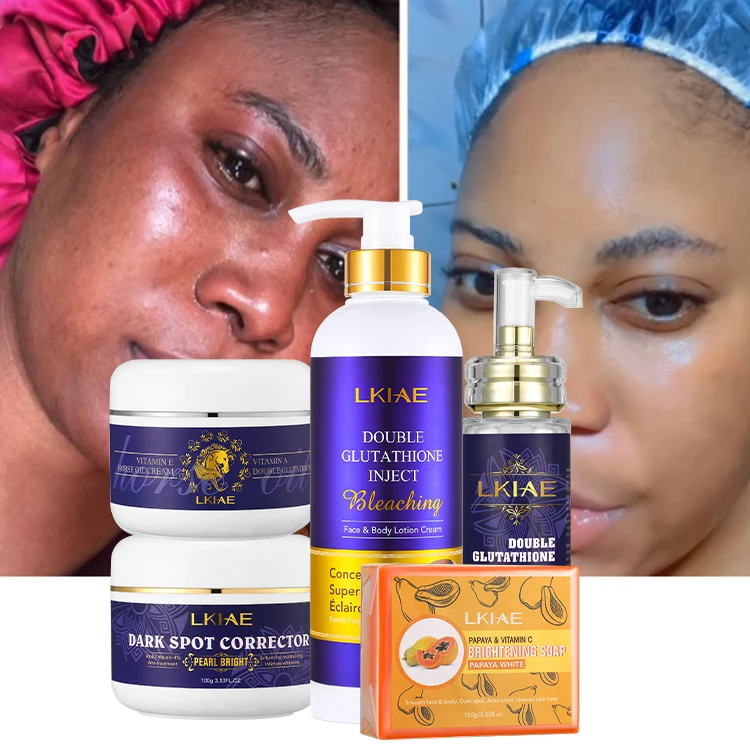 best vitamin c glutathione black skin whitening cream SENTA L- and Face for Whitening, Anti Ageing and Glass Skin, Enrich with Natural Actives, 50 Gm : Beauty & Personal Care Refresh your glow with the INNISFREE Vitamin C Cream The 11 Best Dark Spot